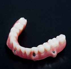 An All-on-4 denture.