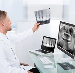 implant dentist looking at X-rays for dental implants