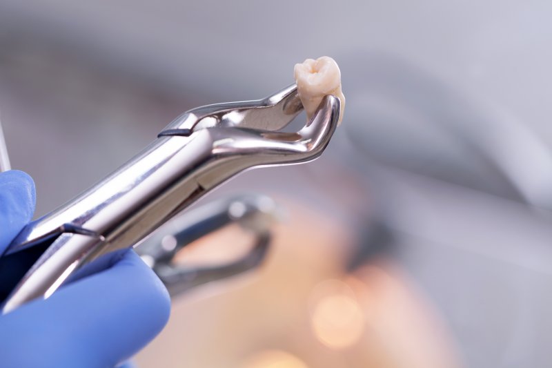 a tooth being held in a set of dental pliers